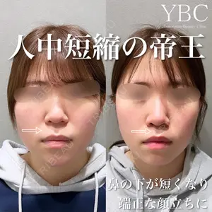 YBC横浜美容外科 大宮院 磯村 亮輔医師の症例