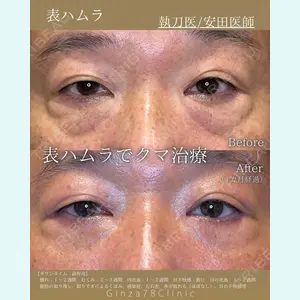 Ginza 78 Clinic 安田百合子医師の症例
