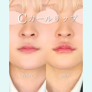 ルラ美容クリニック 札幌大通り院 能登 貴弘医師の症例