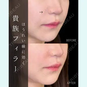 ルラ美容クリニック 大宮院 / ルラスキンクリニック 大宮院 右京 大季医師の症例