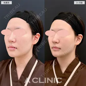 A CLINIC（エークリニック） 名古屋院 住田 篤紀医師の症例