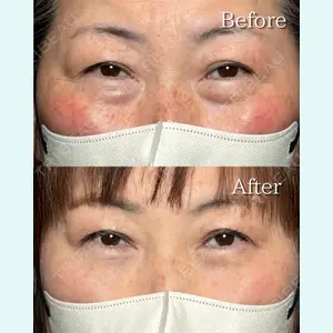 RÉ CLINIQUE SENDAIの症例