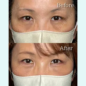 RÉ CLINIQUE SENDAIの症例