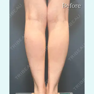 RÉ CLINIQUE SENDAIの症例