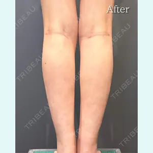 RÉ CLINIQUE SENDAIの症例