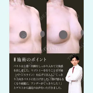 症例