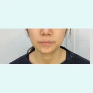 APスキンクリニック銀座 望月 智弘医師の症例