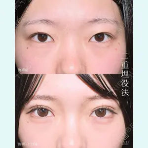 症例