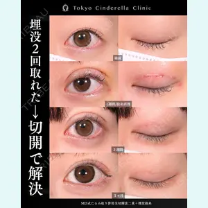 症例