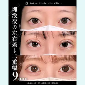 症例