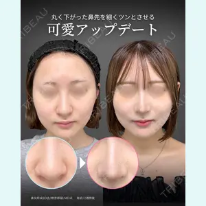 症例