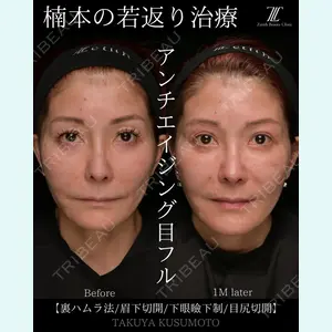 Zetith Beauty Clinic 大阪心斎橋院 楠本 拓哉医師の症例