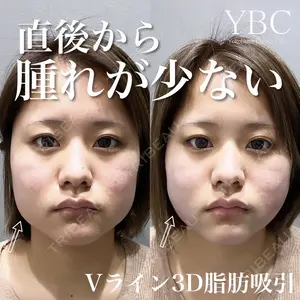 YBC横浜美容外科 大宮院 磯村 亮輔医師の症例