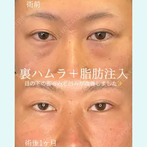 ルラ美容クリニック 仙台院 / ルラスキンクリニック 仙台院 橋本 英樹医師の症例