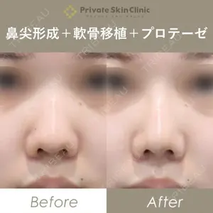 症例