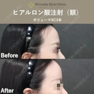 症例