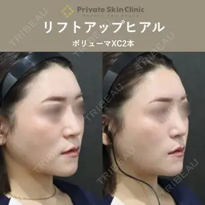 症例