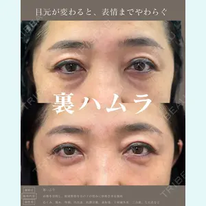 症例