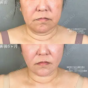 アリエル美容クリニック 大宮院 鈴木　桂介医師の症例