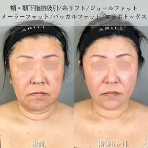 アリエル美容クリニック 大宮院 鈴木　桂介医師の症例