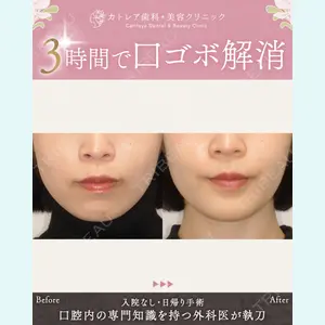 症例