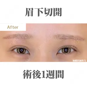 症例