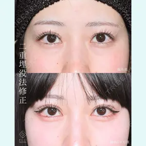 症例