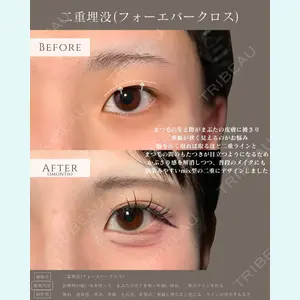 症例