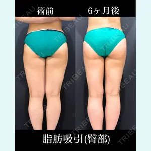 症例