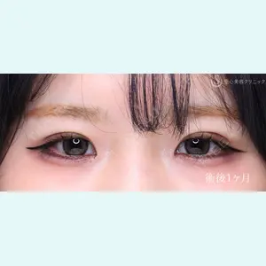 症例