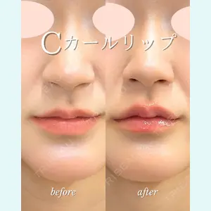 ルラ美容クリニック 札幌大通り院 能登 貴弘医師の症例