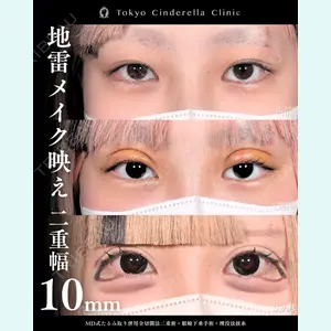症例