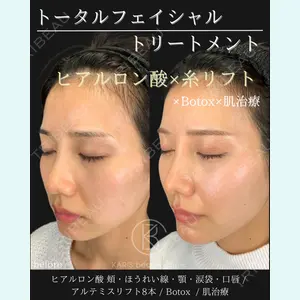 KARIS beauty clinic 滝内 ヒロフミ医師の症例