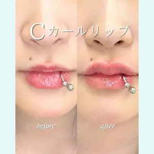 ルラ美容クリニック 札幌大通り院 能登 貴弘医師の症例