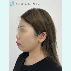 SEA CLINIC（シークリニック） 沼澤 茂医師の症例