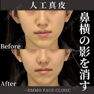 症例