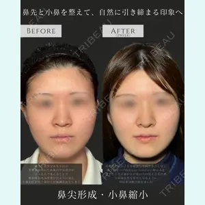 症例