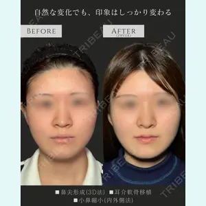 症例