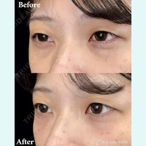 AI Beauty Clinic （エーアイ美容クリニック） 田中 里佳医師の症例