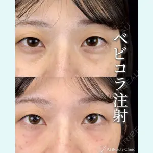 AI Beauty Clinic （エーアイ美容クリニック） 田中 里佳医師の症例