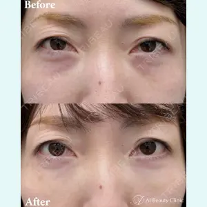 AI Beauty Clinic （エーアイ美容クリニック） 尾崎 宥文医師の症例