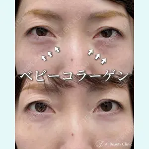 AI Beauty Clinic （エーアイ美容クリニック） 尾崎 宥文医師の症例