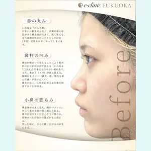 eクリニック 福岡院 伊藤 渉医師の症例