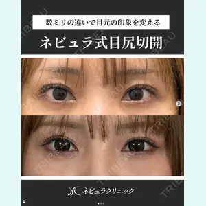 愛知春日井美容外科ネビュラクリニック 都築 諒医師の症例