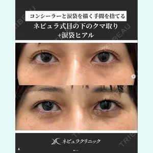 愛知春日井美容外科ネビュラクリニック 都築 諒医師の症例