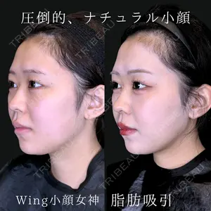 Wing clinic 豊中駅前院 速水 翼医師の症例