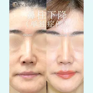 eクリニック 福岡院 伊藤 渉医師の症例