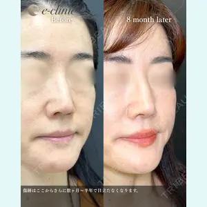 eクリニック 福岡院 伊藤 渉医師の症例