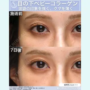 聖心美容クリニック 六本木院 佐藤 航司医師の症例