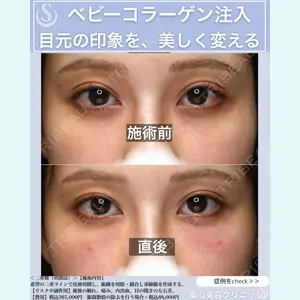 聖心美容クリニック 六本木院 佐藤 航司医師の症例